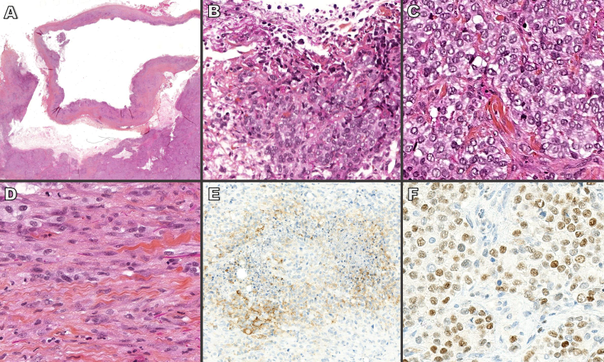Histological findings